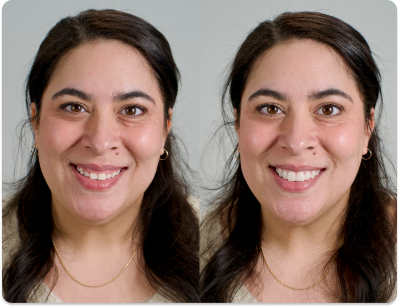 Before and after image of a woman smiling